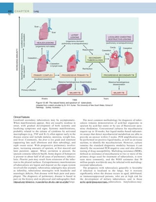 498 C H A P T E R
12
Lung
The most common methodology for diagnosis of tuber-
culosis remains demonstration of acid-fast organisms in
sputum by acid-fast stains or by use of ﬂuorescent aura-
mine rhodamine. Conventional cultures for mycobacteria
require up to 10 weeks, but liquid media–based radiomet-
ric assays that detect mycobacterial metabolism are able to
provide an answer within 2 weeks. PCR ampliﬁcation can
be performed on positive liquid media, as well as on tissue
sections, to identify the mycobacterium. However, culture
remains the standard diagnostic modality because it can
identify the occasional PCR-negative case and also allows
testing of drug susceptibility. Multidrug resistance (MDR),
deﬁned as resistance of mycobacteria to two or more of the
primary drugs used for treatment of tuberculosis, is now
seen more commonly, and the WHO estimates that 50
million people worldwide may be infected with multidrug-
resistant tuberculosis.
The prognosis with tuberculosis generally is favorable
if infection is localized to the lungs, but it worsens
signiﬁcantly when the disease occurs in aged, debilitated,
or immunosuppressed persons, who are at high risk for
the development of miliary tuberculosis, and in those
with multidrug-resistant tuberculosis. Amyloidosis may
Clinical Features
Localized secondary tuberculosis may be asymptomatic.
When manifestations appear, they are usually insidious in
onset, with gradual development of both systemic and
localizing symptoms and signs. Systemic manifestations,
probably related to the release of cytokines by activated
macrophages (e.g., TNF and IL-1), often appear early in the
disease course and include malaise, anorexia, weight loss,
and fever. Commonly, the fever is low grade and remittent
(appearing late each afternoon and then subsiding), and
night sweats occur. With progressive pulmonary involve-
ment, increasing amounts of sputum, at ﬁrst mucoid and
later purulent, appear. When cavitation is present, the
sputum contains tubercle bacilli. Some degree of hemoptysis
is present in about half of all cases of pulmonary tubercu-
losis. Pleuritic pain may result from extension of the infec-
tion to the pleural surfaces. Extrapulmonary manifestations
of tuberculosis are legion and depend on the organ system
involved (for example, tuberculous salpingitis may present
as infertility, tuberculous meningitis with headache and
neurologic deﬁcits, Pott disease with back pain and para-
plegia). The diagnosis of pulmonary disease is based in
part on the history and on physical and radiographic ﬁnd-
ings of consolidation or cavitation in the apices of the lungs.
INCREASINGIMMUNITY
TIME
Primary infection
Spreadinglesions,
littlecaseation
Localizedlesions,
morecaseation
Weeks Years
(localized caseation)
Caseation
PRIMARY COMPLEX
Massive hematogenous dissemination
Liver Spleen
Reactivation
Caseation
in lymph node
Reinfection
CaseationCavity
Caseation
Scar
(organisms dormant;
pulmonary or extrapulmonary)
PROGRESSIVE PRIMARYTB
MILIARYTB
SECONDARY
TUBERCULOSIS
LATENT
LESIONS
(organisms not viable)
Scar
Scar
HEALED LESIONS
Massive hematogenous
dissemination
PROGRESSIVE SECONDARYTB
MILIARYTB
LOCALIZED CASEATING
DESTRUCTIVE LESIONS
(pulmonary or extrapulmonary)
Figure 12–40 The natural history and spectrum of tuberculosis.
(Adapted from a sketch provided by Dr. R.K. Kumar, The University of New South Wales, School of
Pathology, Sydney, Australia.)
Ultimately, however, tubercle bacilli must be identiﬁed. develop in persistent cases.
 