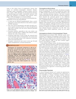 Pulmonary Infections 501
name to the classic form of symptomatic disease that
occurs in neonates—cytomegalic inclusion disease.
Although classic cytomegalic inclusion disease involves
many organs, CMV infections are discussed here because
in immunosuppressed adults, particularly patients with
AIDS and recipients of allogeneic bone marrow trans-
plants, CMV pneumonitis is a serious problem.
Transmission of CMV can occur by several mechanisms,
depending on the age group affected:
• A fetus can be infected transplacentally from a newly
acquired or reactivated infection in the mother (congeni-
tal CMV infection).
• The virus can be transmitted to the baby through cervi-
cal or vaginal secretions at birth, or, later, through breast
milk from a mother who has active infection (perinatal
CMV infection).
• Preschool children, especially in day care centers, can
acquire it through saliva. Toddlers thus infected readily
transmit the virus to their parents.
• In patients older than 15 years of age, the venereal route
is the dominant mode of transmission, but spread also
may occur through contact with respiratory secretions
and by the fecal-oral route.
• Iatrogenic transmission can occur at any age through
organ transplantation or blood transfusions.
MORPHOLOGY
Histologically, the characteristic enlargement of cells can be
appreciated. In the glandular organs, the parenchymal epithe-
lial cells are affected; in the brain, the neurons; in the lungs,
the alveolar macrophages and epithelial and endothelial cells;
and in the kidneys, the tubular epithelial and glomerular endo-
thelial cells. Affected cells are strikingly enlarged, often to
a diameter of 40 μm, and exhibit cellular and nuclear
polymorphism. Prominent intranuclear basophilic inclusions
spanning half the nuclear diameter are usually set off from the
nuclear membrane by a clear halo (Fig. 12–42). Within the
cytoplasm of these cells, smaller basophilic inclu- sions may
alsobe seen.
CytomegalovirusMononucleosis
In healthy young children and adults, the disease is nearly
always asymptomatic. In surveys around the world, 50%
to 100% of adults demonstrate anti-CMV antibodies in the
serum, indicating previous exposure. The most common
clinical manifestation of CMV infection in immunocompetent
hosts beyond the neonatal period is an infectious
mononucleosis–like illness, with fever, atypical lymphocy-
tosis, lymphadenopathy, and hepatomegaly accompanied
by abnormal liver function test results, suggesting mild
hepatitis. Most patients recover from CMV mononucleosis
without any sequelae, although excretion of the virus may
occur in body ﬂuids for months to years. Irrespective of the
presence or absence of symptoms after infection, a person
once infected becomes seropositive for life. The virus
remains latent within leukocytes, which are the major
reservoirs.
Cytomegalovirus Infection in Immunosuppressed Persons
Immunosuppression-related CMV infection occurs most
commonly in recipients of transplants (such as heart, liver,
kidney, lung, or allogeneic stem cell) and in patients with
AIDS. This can be either primary infection or reactiva- tion
of a latent infection. CMV is the most common oppor-
tunistic viral pathogen in AIDS.
In all of these settings, serious, life-threatening dissemi-
nated CMV infections primarily affect the lungs (pneumo-
nitis), gastrointestinal tract (colitis), and retina (retinitis);
the central nervous system usually is spared. In pneumo-
nitis, an interstitial mononuclear inﬁltrate with foci of
necrosis develops, accompanied by the typical enlarged
cells with inclusions, which can progress to ARDS. Intesti-
nal necrosis and ulceration can develop and be extensive,
leading to the formation of “pseudomembranes” (Chapter
14) and debilitating diarrhea. CMV retinitis, by far the
most common form of opportunistic CMV disease, can
occur either alone or in combination with involvement of
the lungs and intestinal tract. Diagnosis of CMV infec-
tion is made by demonstration of characteristic viral inclu-
sions in tissue sections, successful viral culture, rising
antiviral antibody titer, and qualitative or quantitative
PCR assay–based detection of CMV DNA. The latter has
revolutionized the approach to monitoring patients after
transplantation.
Pneumocystis Pneumonia
P. jiroveci (formerly known as P. carinii), an opportunistic
infectious agent formerly considered to be a protozoan, is
now classiﬁed as a fungus. Serologic evidence indicates
that virtually all persons are exposed to Pneumocystis
during the ﬁrst few years of life, but in most the infection
remains latent. Reactivation with development of clinical
disease occurs almost exclusively in persons who are
immunocompromised. Indeed, P. jiroveci is an extremely
common cause of infection in patients with AIDS, and it
also may infect severely malnourished infants and immu-
nosuppressed persons (especially after organ transplanta-
tion or in persons receiving cytotoxic chemotherapy or
corticosteroids). In patients with AIDS, the risk of acquir-
ing P. jiroveci infections increases in inverse proportion toFigure 12–42 Cytomegalovirus infection of the lung. A typical distinct
the CD4+ count, with counts less than 200 cells/ L havingnuclear and multiple cytoplasmic inclusions are seen in an enlarged cell.
 