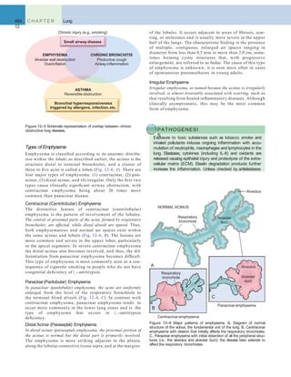 464 C H A P T E R
12
Lung
of the lobules. It occurs adjacent to areas of ﬁbrosis, scar-
ring, or atelectasis and is usually more severe in the upper
half of the lungs. The characteristic ﬁnding is the presence
of multiple, contiguous, enlarged air spaces ranging in
diameter from less than 0.5 mm to more than 2.0 cm, some-
times forming cystic structures that, with progressive
enlargement, are referred to as bullae. The cause of this type
of emphysema is unknown; it is seen most often in cases
of spontaneous pneumothorax in young adults.
Irregular Emphysema
Irregular emphysema, so named because the acinus is irregularly
involved, is almost invariably associated with scarring, such as
that resulting from healed inﬂammatory diseases. Although
clinically asymptomatic, this may be the most common
form of emphysema.
Figure 12–5 Schematic representation of overlap between chronic
obstructive lung diseases.
Small airwaydisease
EMPHYSEMA
Alveolar wall destruction
Overinflation
CHRONICBRONCHITIS
Productive cough
Airway inflammation
ASTHMA
Reversible obstruction
Bronchial hyperresponsiveness
triggered by allergens, infection, etc.
Chronic injury (e.g., smoking)
NORMAL ACINUS
A
B
C
Respiratory
bronchiole
Respiratory
bronchiole
Alveolar
duct
Alveolar
duct
Alveolus
Alveolus
Centriacinaremphysema
Figure 12–6 Major patterns of emphysema. A, Diagram of normal
structure of the acinus, the fundamental unit of the lung. B, Centriacinar
emphysema with dilation that initially affects the respiratory bronchioles.
C, Panacinar emphysema with initial distention of all the peripheral struc-
tures (i.e., the alveolus and alveolar duct); the disease later extends to
affect the respiratory bronchioles.
Panacinar emphysema
Types of Emphysema
Emphysema is classiﬁed according to its anatomic distribu-
tion within the lobule; as described earlier, the acinus is the
structure distal to terminal bronchioles, and a cluster of
three to ﬁve acini is called a lobule (Fig. 12–6, A). There are
four major types of emphysema: (1) centriacinar, (2) pan-
acinar, (3) distal acinar, and (4) irregular. Only the ﬁrst two
types cause clinically signiﬁcant airway obstruction, with
centriacinar emphysema being about 20 times more
common than panacinar disease.
Centriacinar (Centrilobular) Emphysema
The distinctive feature of centriacinar (centrilobular)
emphysema is the pattern of involvement of the lobules:
The central or proximal parts of the acini, formed by respiratory
bronchioles, are affected, while distal alveoli are spared. Thus,
both emphysematous and normal air spaces exist within
the same acinus and lobule (Fig. 12–6, B). The lesions are
more common and severe in the upper lobes, particularly
in the apical segments. In severe centriacinar emphysema
the distal acinus also becomes involved, and thus, the dif-
ferentiation from panacinar emphysema becomes difﬁcult.
This type of emphysema is most commonly seen as a con-
sequence of cigarette smoking in people who do not have
congenital deﬁciency of  1-antitrypsin.
Panacinar(Panlobular) Emphysema
In panacinar (panlobular) emphysema, the acini are uniformly
enlarged, from the level of the respiratory bronchiole to
the terminal blind alveoli (Fig. 12–6, C). In contrast with
centriacinar emphysema, panacinar emphysema tends to
occur more commonly in the lower lung zones and is the
type of emphysema that occurs in  1-antitrypsin
deﬁciency.
Distal Acinar (Paraseptal) Emphysema
In distal acinar (paraseptal) emphysema, the proximal portion of
the acinus is normal but the distal part is primarily involved.
The emphysema is more striking adjacent to the pleura,
along the lobular connective tissue septa, and at the margins
PATHOGENESI
SExposure to toxic substances such as tobacco smoke and
inhaled pollutants induces ongoing inﬂammation with accu-
mulation of neutrophils, macrophages and lymphocytes in the
lung. Elastases, cytokines (including IL-8) and oxidants are
released causing epithelial injury and proteolysis of the extra-
cellular matrix (ECM). Elastin degradation products further
increase the inﬂammation. Unless checked by antielastases
 