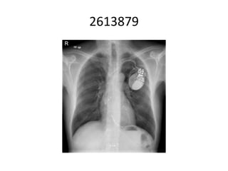 2613879
 