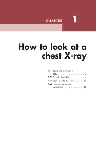 CHAPTER                  1


How to look at a
     chest X-ray
      1.1 Basic interpretation is
          easy                       2
      1.2 Technical quality          4
      1.3 Scanning the PA film      10
      1.4 How to look at the
          lateral film              13
 