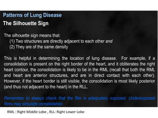 Reading chest X-ray | PDF