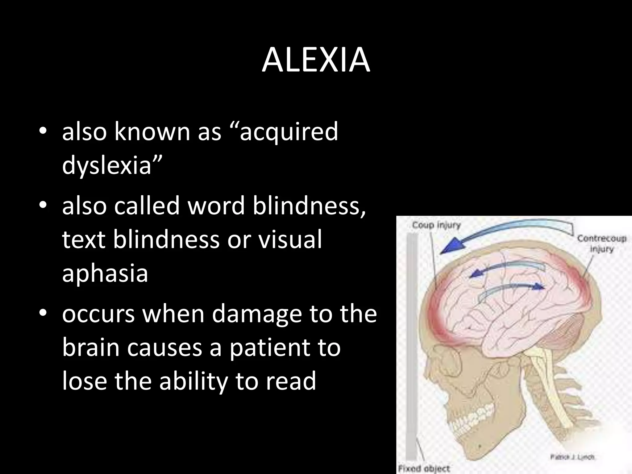 ALEXIA
• also known as “acquired
dyslexia”
• also called word blindness,
text blindness or visual
aphasia
• occurs when damage to the
brain causes a patient to
lose the ability to read
 
