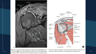 Readin Mri Reading Magnetic Resonance Imaging (MRI) in Orthopaedics | PPTX