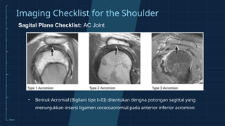 Reading Magnetic Resonance Imaging (MRI) in Orthopaedics | PPTX