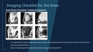 Mri Knee Ordering Guide.pdf Reading Magnetic Resonance Imaging (MRI) in Orthopaedics | PPTX
