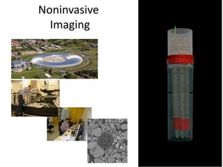 Noninvasive
Imaging
 