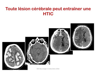 Toute lésion cérébrale peut entraîner une
HTIC
DES	Neurologie	15	décembre	2016	
 