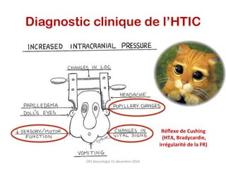 Diagnostic clinique de l’HTIC
Réﬂexe	de	Cushing	
	(HTA,	Bradycardie,	
irrégularité	de	la	FR)	
DES	Neurologie	15	décembre	2016	
 