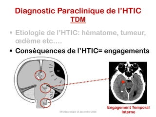 Diagnostic Paraclinique de l’HTIC
TDM
§  Etiologie de l’HTIC: hématome, tumeur,
œdème etc….
§  Conséquences de l’HTIC= engagements
DES	Neurologie	15	décembre	2016	
Engagement Temporal
Interne
 