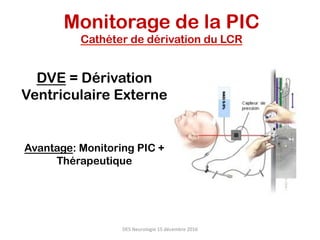 Monitorage de la PIC
Cathéter de dérivation du LCR
DVE = Dérivation
Ventriculaire Externe
Avantage: Monitoring PIC +
Thérapeutique
DES	Neurologie	15	décembre	2016	
 