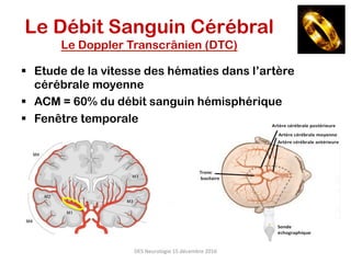 DES	Neurologie	15	décembre	2016	
Le Débit Sanguin Cérébral
Le Doppler Transcrânien (DTC)
§  Etude de la vitesse des hématies dans l’artère
cérébrale moyenne
§  ACM = 60% du débit sanguin hémisphérique
§  Fenêtre temporale
 