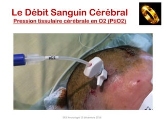 DES	Neurologie	15	décembre	2016	
Le Débit Sanguin Cérébral
Pression tissulaire cérébrale en O2 (PtiO2)
 