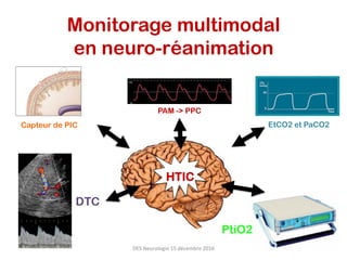Monitorage multimodal
en neuro-réanimation
PAM -> PPC
EtCO2 et PaCO2Capteur de PIC
DTC
HTIC
PtiO2
DES	Neurologie	15	décembre	2016	
 
