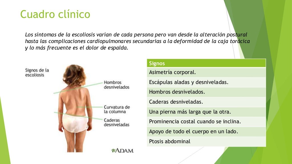 Presentación caso clínico Escoliosis