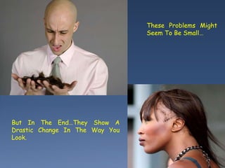 These Problems Might
Seem To Be Small…
But In The End…They Show A
Drastic Change In The Way You
Look.
 