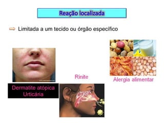 Limitada a um tecido ou órgão específico

Dermatite atópica
Urticária

 