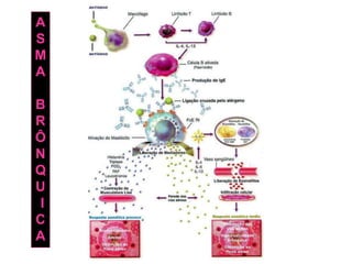 A
S
M
A
B
R
Ô
N
Q
U
I
C
A

 