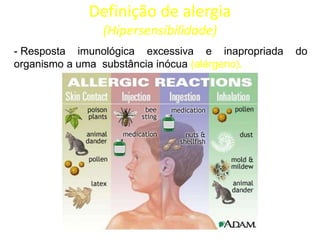Definição de alergia
(Hipersensibilidade)
- Resposta imunológica excessiva e inapropriada
organismo a uma substância inócua (alérgeno).

do

 