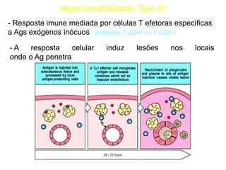 Hipersensibilidade Tipo IV
- Resposta imune mediada por células T efetoras específicas
a Ags exógenos inócuos (linfócitos T CD4+ ou T CD8+)

-A
resposta
celular
onde o Ag penetra

induz

lesões

nos

locais

 