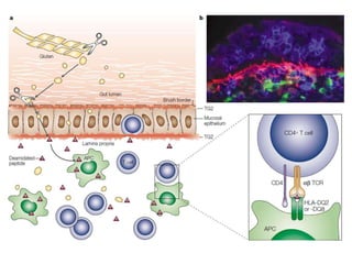 Reações de-hipersensibilidade