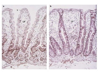 Reações de-hipersensibilidade
