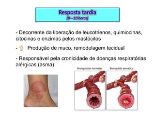 - Decorrente da liberação de leucotrienos, quimiocinas,
citocinas e enzimas pelos mastócitos
-

Produção de muco, remodelagem tecidual

- Responsável pela cronicidade de doenças respiratórias
alérgicas (asma)

 