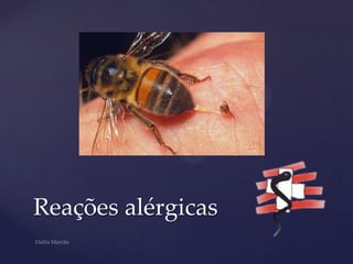 Reações alérgicas
 