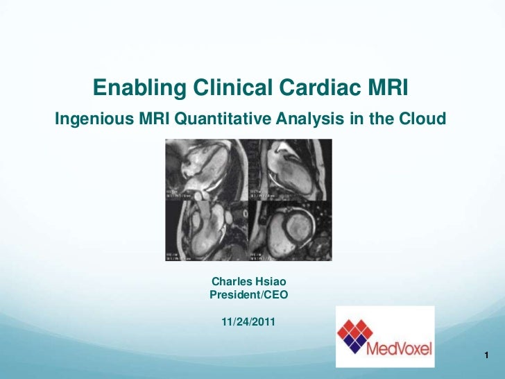 Real time qp qs measurement with automatic segementation