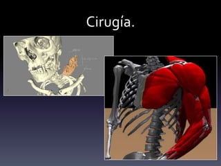 Cirugía.