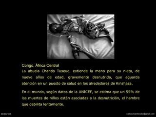 Congo, África Central La abuela Chantis Tuseuo, extiende la mano para su nieta,  de nueve años de edad,   gravemente desnutrida,  que aguarda atención en un puesto de salud en los alrededores de Kinshasa.  En el mundo, según datos de la UNICEF, se estima que un 55% de las muertes de niños están asociadas a la desnutrición, el hambre que debilita lentamente.  