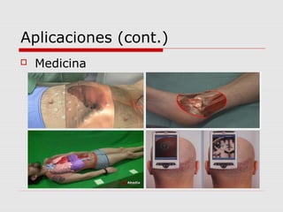 Aplicaciones (cont.)
 Medicina
 