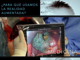 M E D I C I N A
¿ PA R A Q U É U S A M O S
L A R E A L I D A D
A U M E N TA D A ?
 