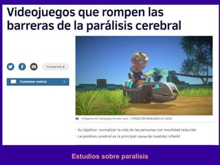 Estudios sobre paralisis
 