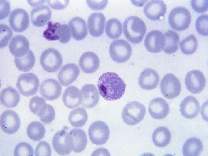 Cuando dar la sangre sobre la lamblia después del tratamiento