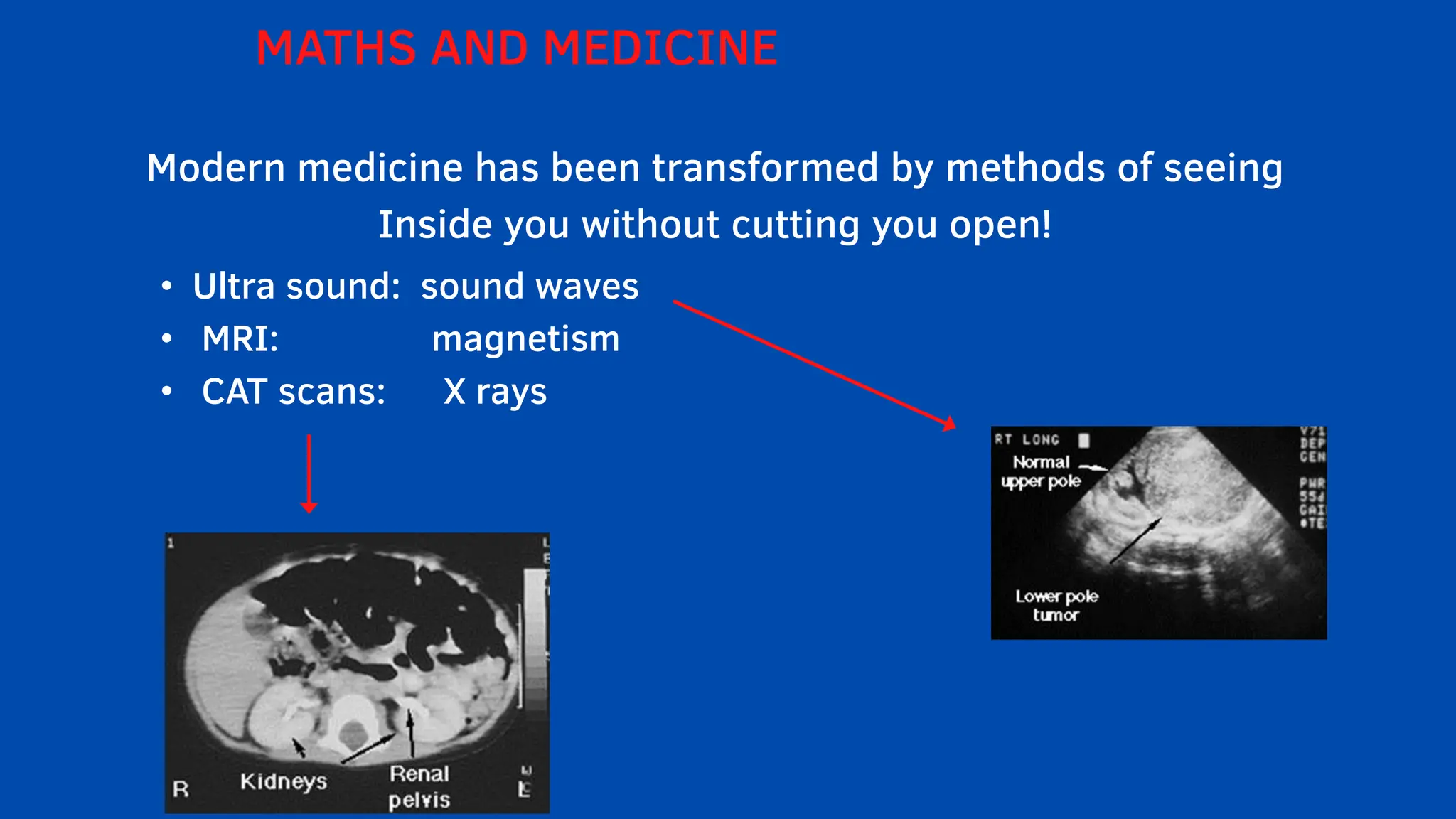 Modern medicine has been transformed by methods of seeing
Inside you without cutting you open!
MATHS AND MEDICINE
• Ultra sound: sound waves
• MRI: magnetism
• CAT scans: X rays
 