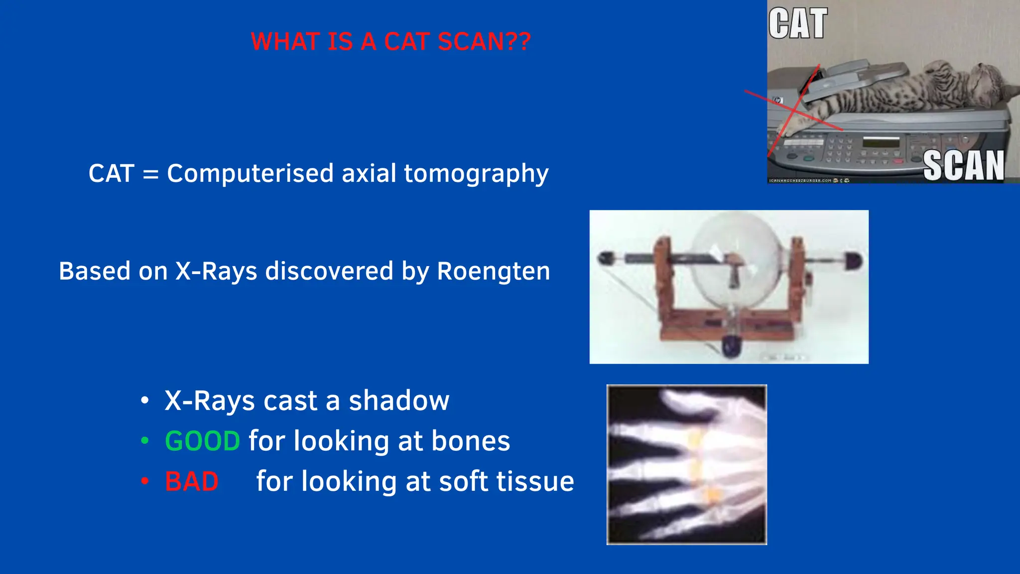 WHAT IS A CAT SCAN??
CAT = Computerised axial tomography
Based on X-Rays discovered by Roengten
• X-Rays cast a shadow
• GOOD for looking at bones
• BAD for looking at soft tissue
 