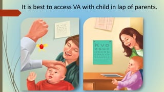 It is best to access VA with child in lap of parents.
 
