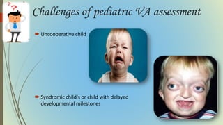 Challenges of pediatric VA assessment
 Uncooperative child
 Syndromic child's or child with delayed
developmental milestones
 