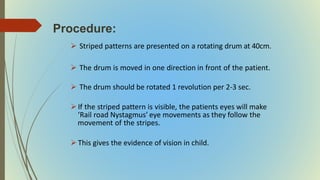 Procedure:
 Striped patterns are presented on a rotating drum at 40cm.
 The drum is moved in one direction in front of the patient.
 The drum should be rotated 1 revolution per 2-3 sec.
If the striped pattern is visible, the patients eyes will make
‘Rail road Nystagmus’ eye movements as they follow the
movement of the stripes.
This gives the evidence of vision in child.
 