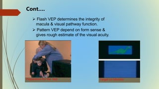  Flash VEP determines the integrity of
macula & visual pathway function.
 Pattern VEP depend on form sense &
gives rough estimate of the visual acuity.
Target on MonitorPreparation for the test
Cont….
 