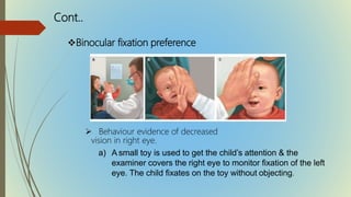  Behaviour evidence of decreased
vision in right eye.
a) A small toy is used to get the child’s attention & the
examiner covers the right eye to monitor fixation of the left
eye. The child fixates on the toy without objecting.
Binocular fixation preference
Cont..
 