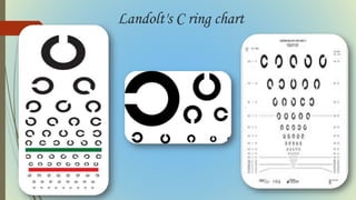 Landolt's C ring chart
 