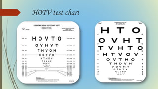 HOTV test chart
 