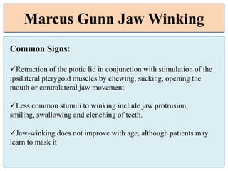 Marcus Gunn Jaw Winking
Common Signs:
Retraction of the ptotic lid in conjunction with stimulation of the
ipsilateral pterygoid muscles by chewing, sucking, opening the
mouth or contralateral jaw movement.
Less common stimuli to winking include jaw protrusion,
smiling, swallowing and clenching of teeth.
Jaw-winking does not improve with age, although patients may
learn to mask it
 