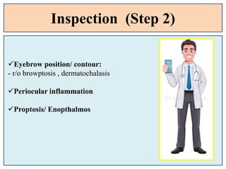 Inspection (Step 2)
Eyebrow position/ contour:
- r/o browptosis , dermatochalasis
Periocular inflammation
Proptosis/ Enopthalmos
 