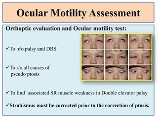 Ocular Motility Assessment
Orthoptic evaluation and Ocular motility test:
To r/o palsy and DRS
To r/o all causes of
pseudo ptosis
To find associated SR muscle weakness in Double elevator palsy
Strabismus must be corrected prior to the correction of ptosis.
 