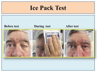 Ice Pack Test
Before test During test After test
 