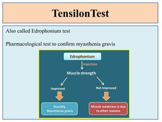 TensilonTest
Also called Edrophonium test
Pharmacological test to confirm myasthenia gravis
 