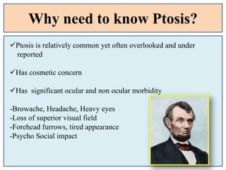 Why need to know Ptosis?
Ptosis is relatively common yet often overlooked and under
reported
Has cosmetic concern
Has significant ocular and non ocular morbidity
-Browache, Headache, Heavy eyes
-Loss of superior visual field
-Forehead furrows, tired appearance
-Psycho Social impact
 